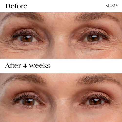 Glov Serum Infused Microneedle Eye Patches Glov Beauty 490291446